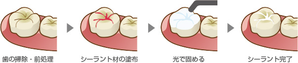 一般歯科
